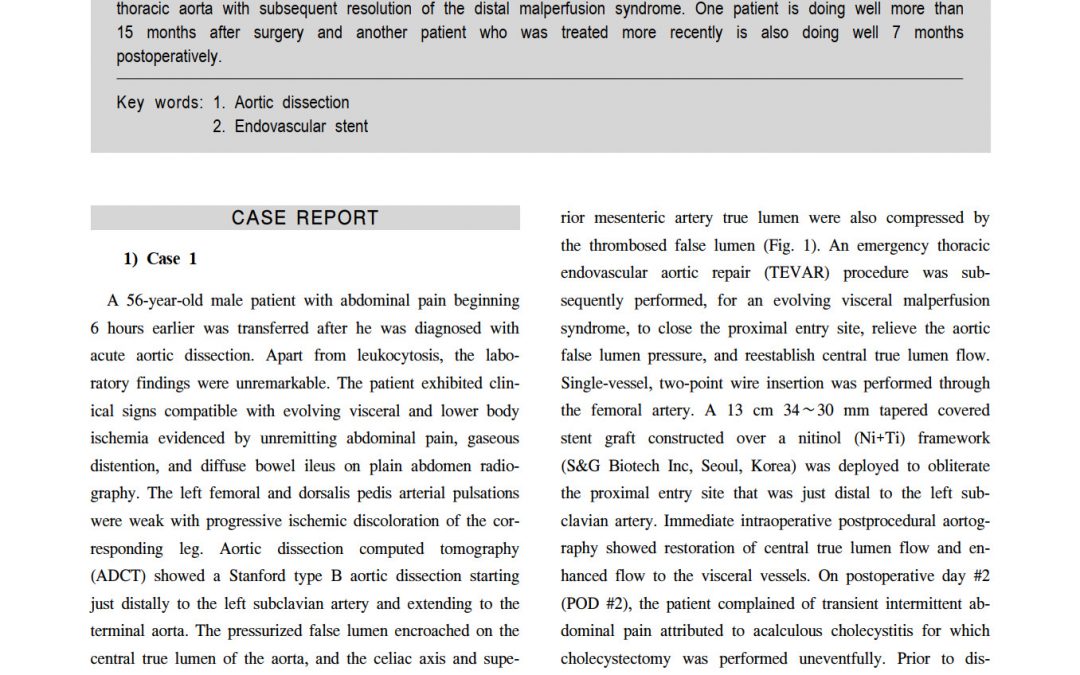 SEAL Flex case report(Flex TEVAR)