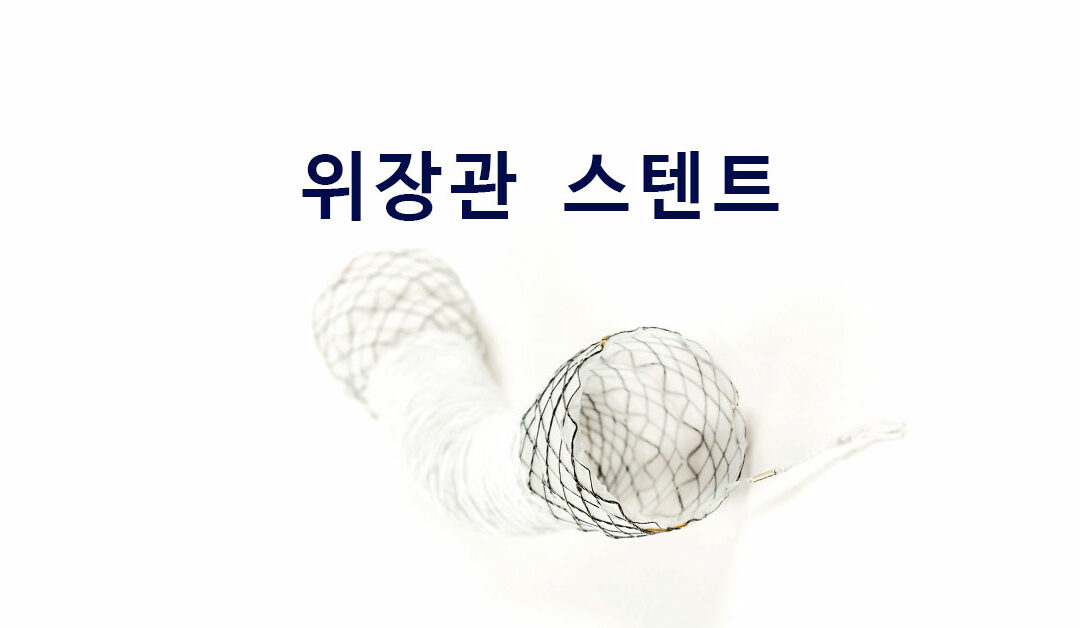 위장관 스텐트