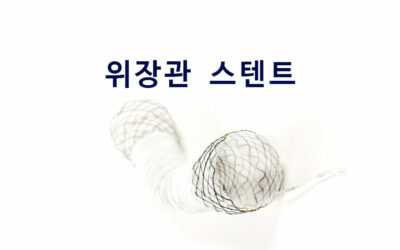 위장관 스텐트